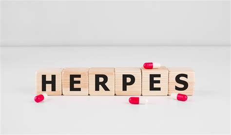 simptome herpes genital|Herpes genital